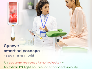 Colposcope | Colposcope Machine | GynEye